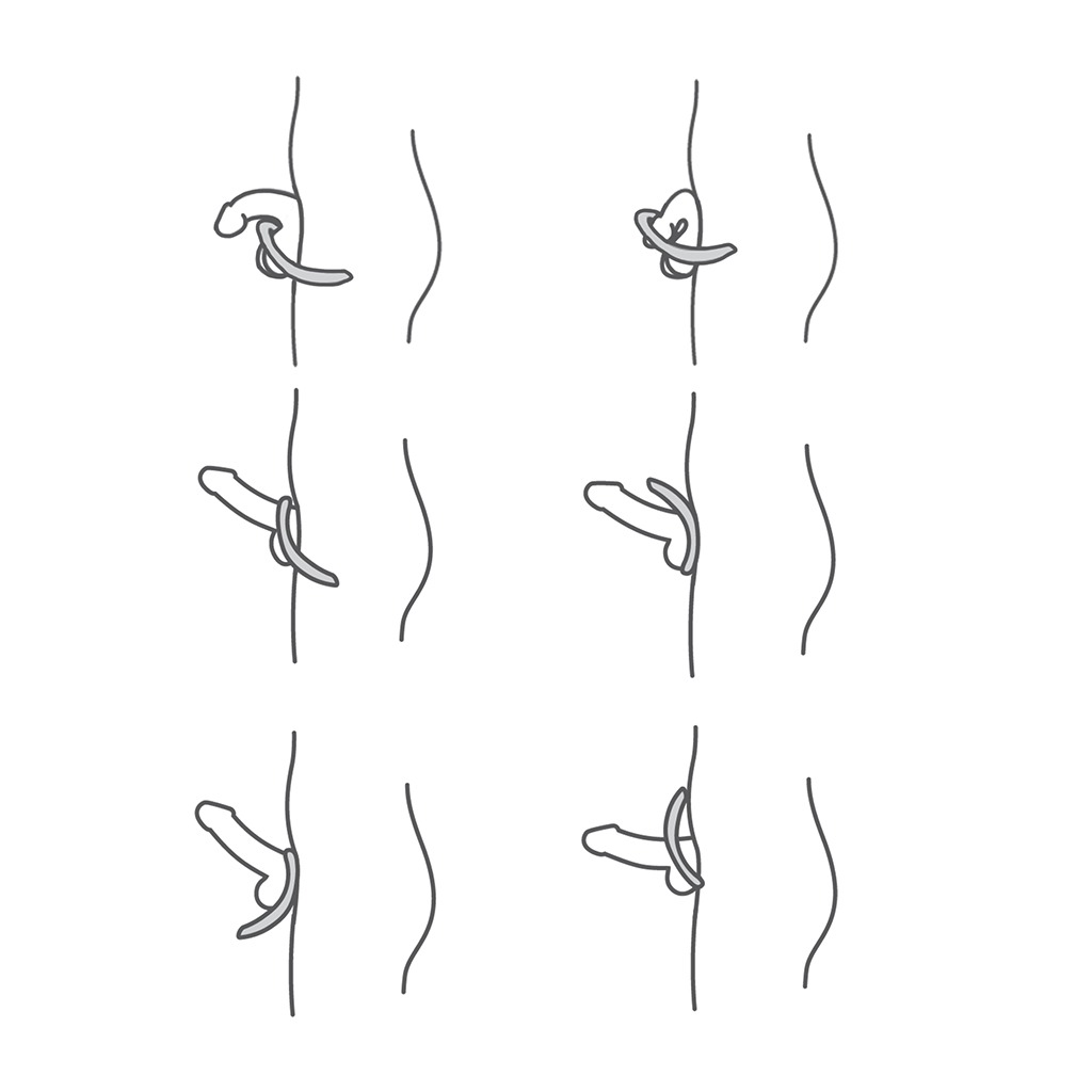 Cockring omdoen